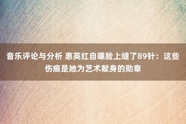 音乐评论与分析 惠英红自曝脸上缝了89针：这些伤痕是她为艺术献身的勋章